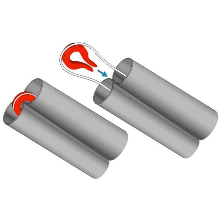 Protectie pentru Elastic Stonfo 2